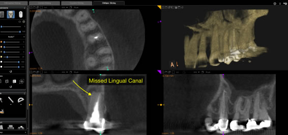 cbct